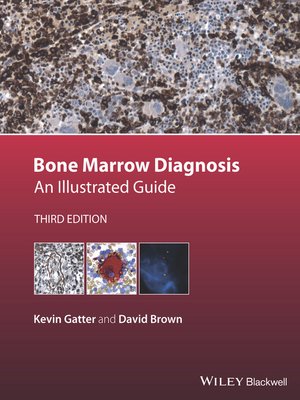 cover image of Bone Marrow Diagnosis